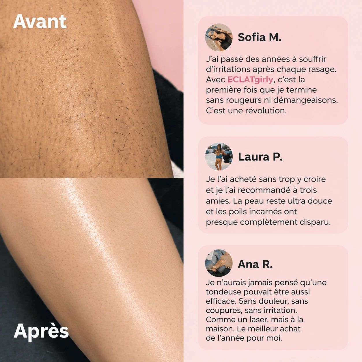 Tondeuse électrique féminine 2 en 1 (bikini + corps)