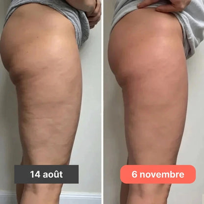 Leggings ECLATgirly 3D – Redéfinissez votre silhouette sans effort