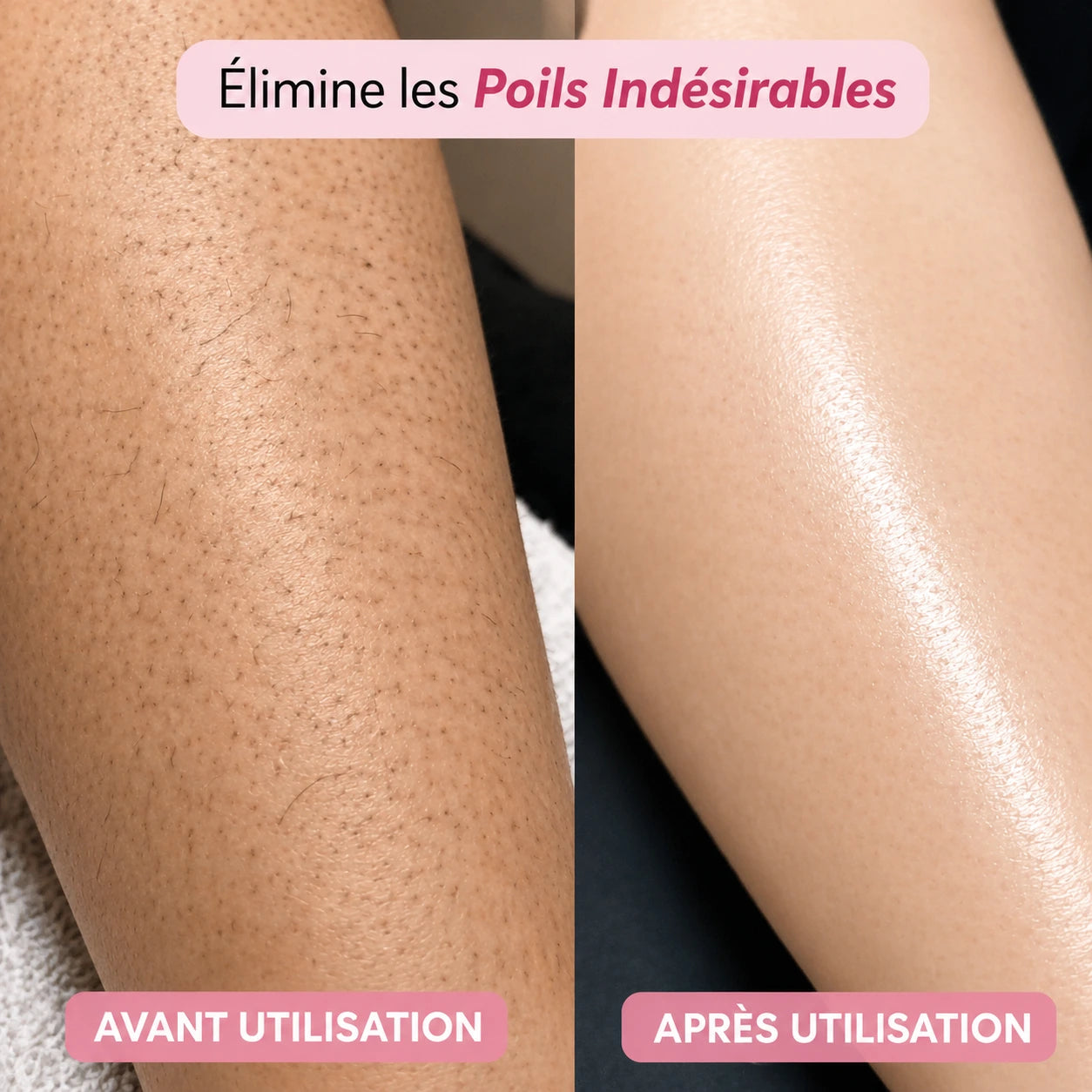 Tondeuse électrique féminine 2 en 1 (bikini + corps)