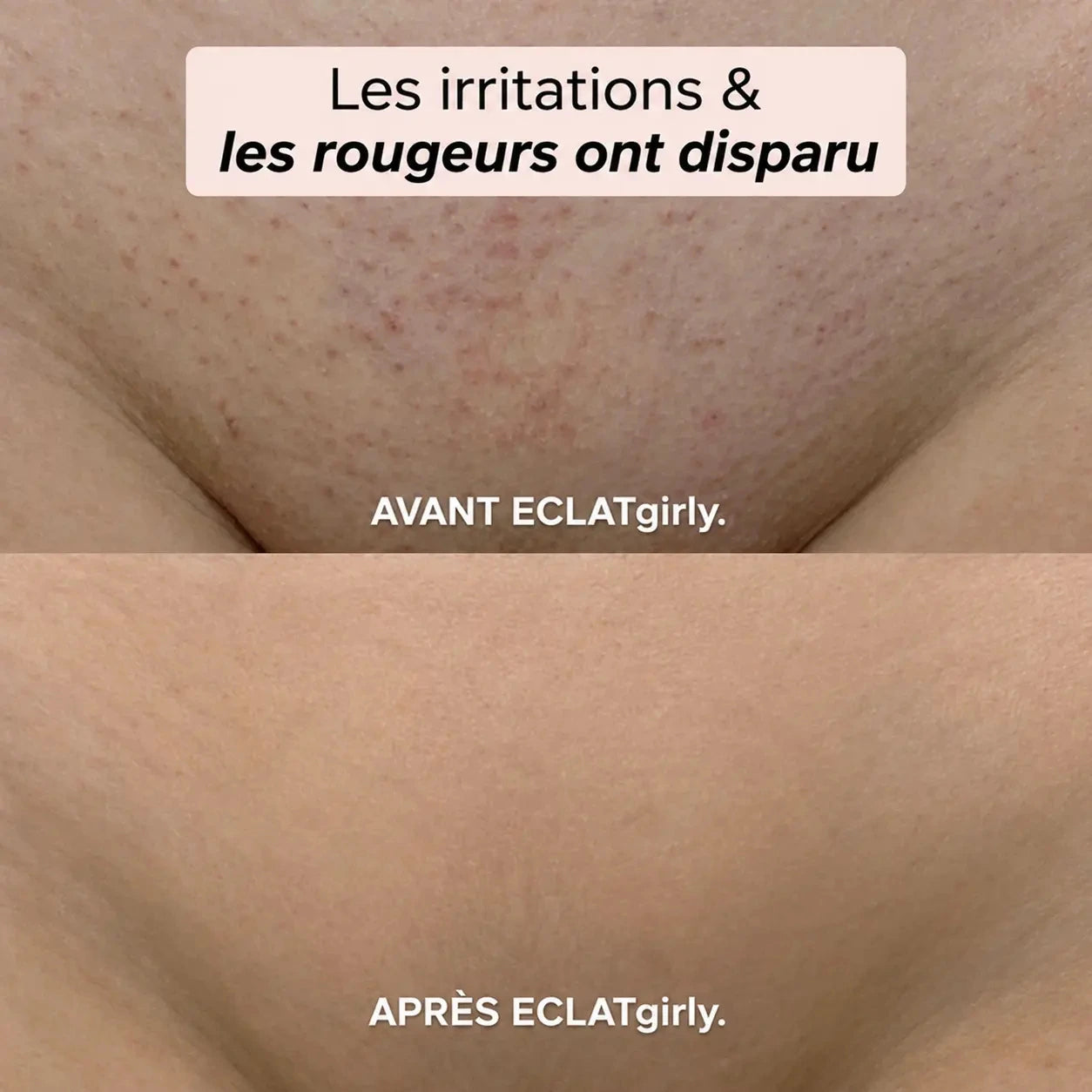 Tondeuse électrique féminine 2 en 1 (bikini + corps)