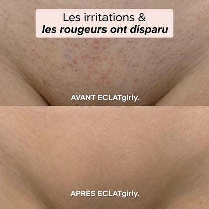 Tondeuse électrique féminine 2 en 1 (bikini + corps)